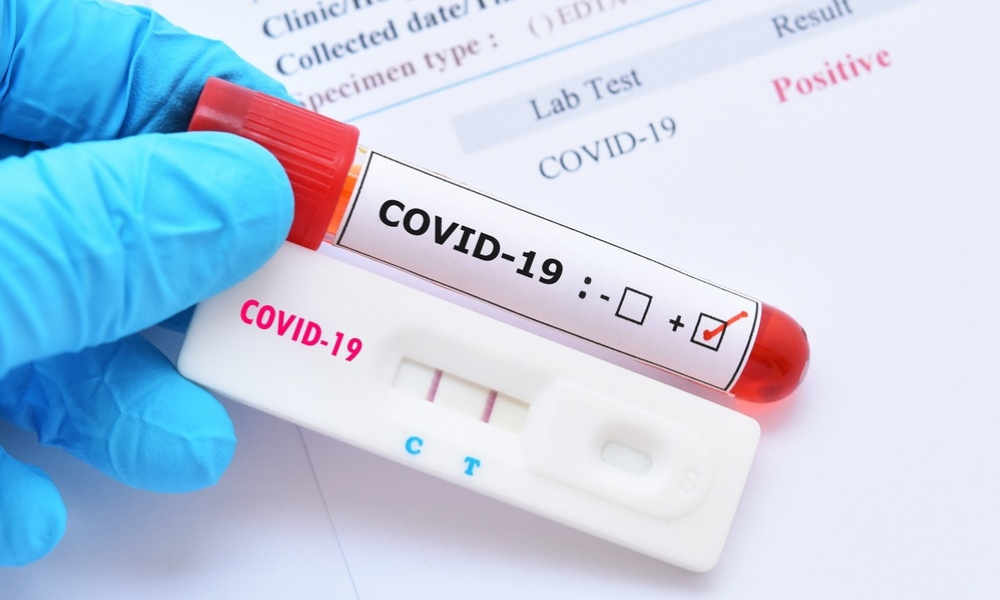 Así puedes tramitar el permiso de incapacidad por covid-19 versión 3.0 del IMSS