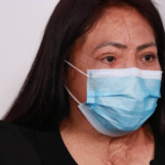 Ataques con ácido se castigarán hasta con 13 años de prisión, determina el Senado