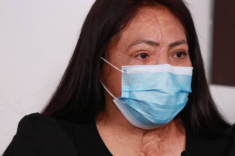 Ataques con ácido se castigarán hasta con 13 años de prisión, determina el Senado